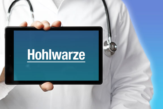 Eingezogene Brustwarzen Hoexter